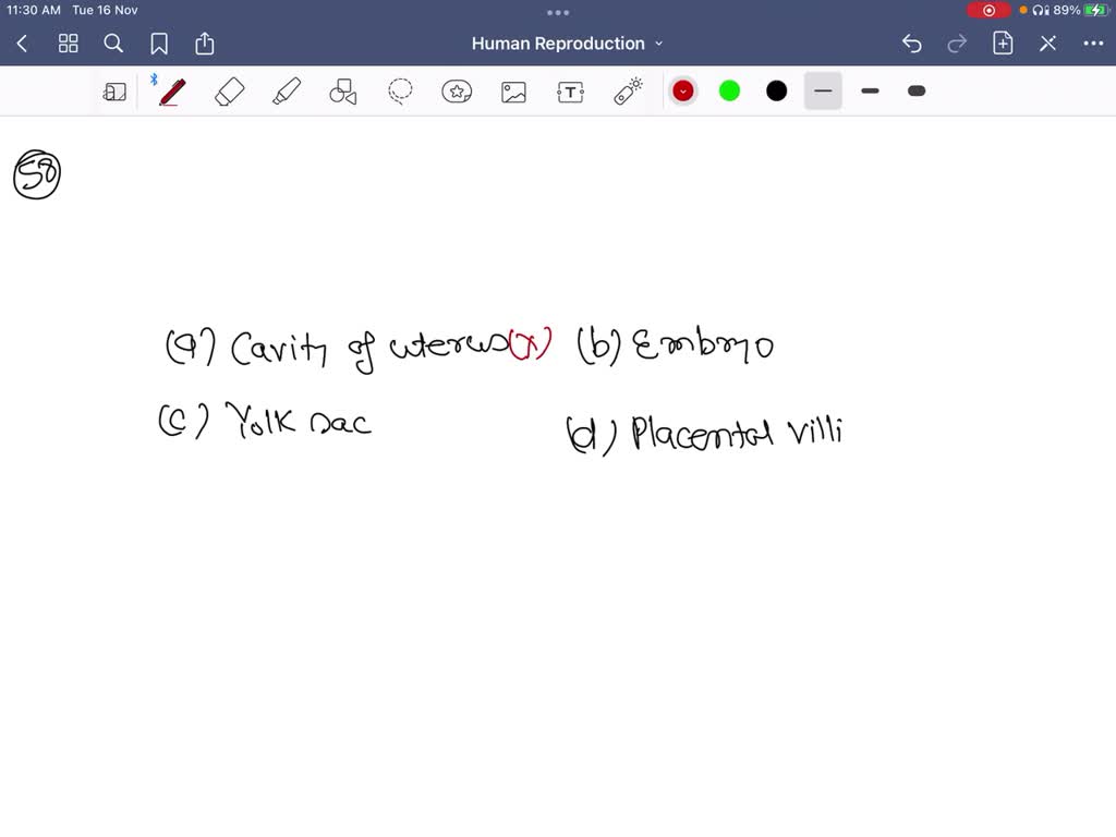 SOLVEDWhat does 'b' represent in the figure? (a) Cavity of uterus (b