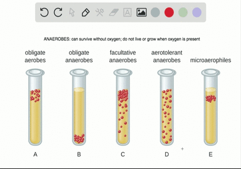 which-of-the-following-terms-best-describes-an-organism-that-camnot-exist-in-the-presence-of-oxygen-