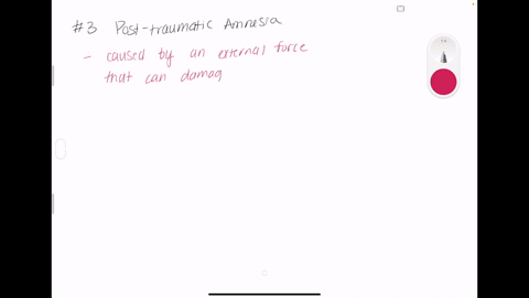 posttraumatic-amnesia-can-be-induced-by-a-electroconvulsive-shock-b-thiamine-c-alcohol-d-repetition-