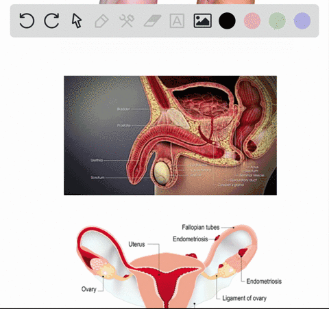 match-each-term-with-the-most-suitable-description-text-epididymis-quad-quadquadquadquad-text-a-carr