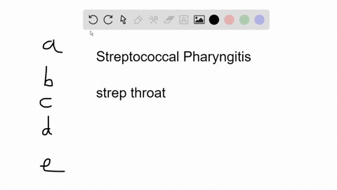 the-following-are-all-complications-of-streptococcal-pharyngitis-except-a-glomerulonephritis-b-scarl