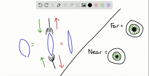 which-reactions-occur-when-a-person-looks-at-a-distant-object-a-pupils-constrict-ciliary-zonule-susp