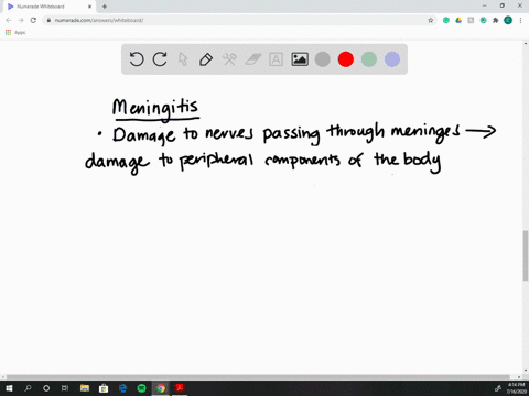 meningitis-is-an-inflammation-of-the-meninges-that-can-have-severe-effects-on-neurological-function-