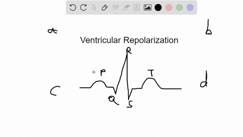 the-repolarization-of-the-ventricles-corresponds-to-which-of-the-following-on-an-ecg-a-the-p-wave-b-