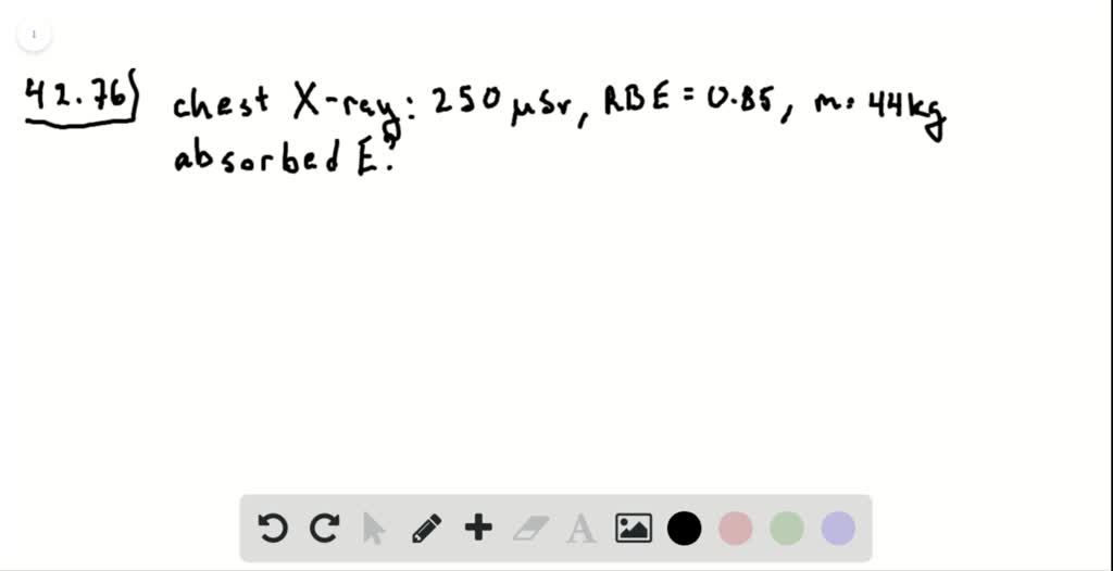 SOLVEDA typical chest xray radiation dose is 250μSv, delivered by x