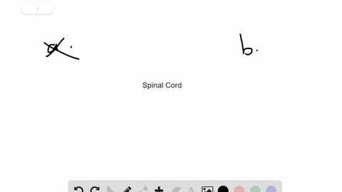 the-spinal-cord-______-a-contains-neuron-cell-bodies-but-no-myelinated-axons-b-evolved-from-the-noto