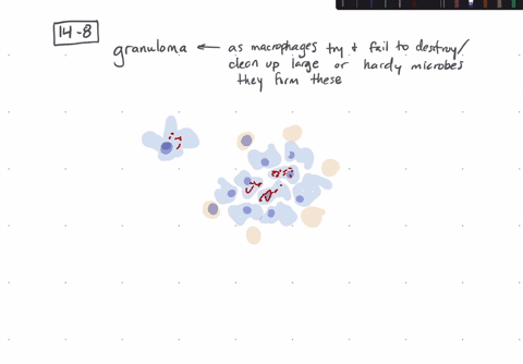 all-of-the-following-cell-types-are-found-in-a-granuloma-except-a-neutrophils-b-macrophages-c-giant-