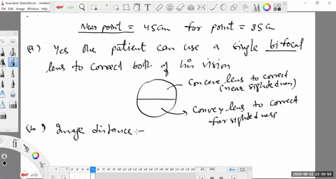 a-patient-has-a-near-point-of-450-mathrmcm-and-far-point-of-850-mathrmcm-a-can-a-single-lens-correct