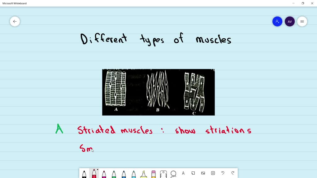 ⏩SOLVED:Identify The Figures A, B, C Showing Different Types And ...