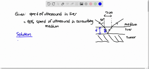 a-narrow-beam-of-ultrasonic-waves-reflects-off-the-liver-tumor-in-figure-p2222-if-the-speed-of-the-2