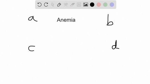 which-of-the-following-can-lead-to-anemia-a-insufficient-iron-in-the-diet-b-insufficient-operatornam