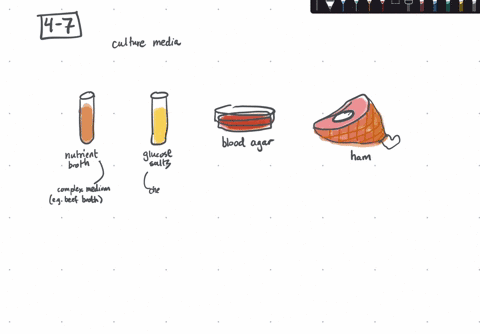 which-of-the-following-is-false-a-e-coli-grows-faster-in-nutrient-broth-than-in-glucose-salts-medi-2