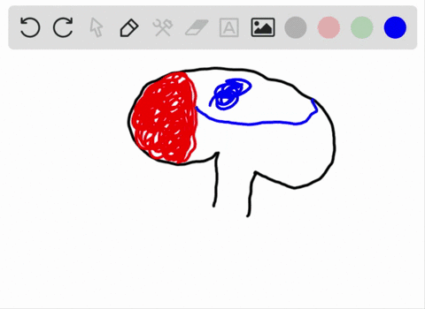 information-from-the-optic-nerve-is-initially-processed-in-what-part-of-the-brain-a-occipital-lobe-b