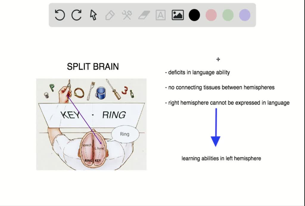 SOLVED:A split-brain patient has a picture of a d…