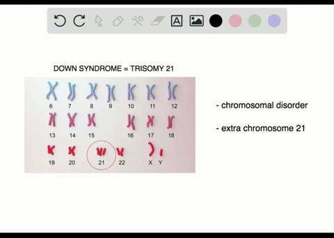 describe-the-cause-of-down-syndrome-chapter-11