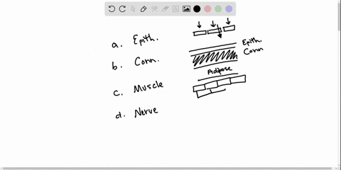 in-your-body-cells-of-_________-can-shorten-contract-a-epithelial-tissue-b-connective-tissue-c-muscl