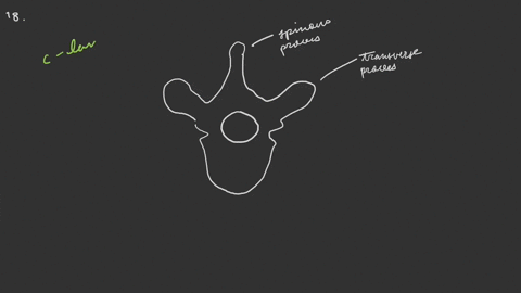 a-typical-vertebra-has-__________-a-a-vertebral-foramen-that-passes-through-the-body-b-a-superior-ar