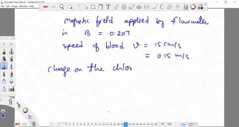 an-electromagnetic-flowmeter-applies-a-magnetic-field-of-020-t-to-blood-flowing-through-a-coronary-a