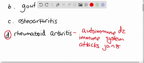 an-autoimmune-disorder-in-which-joints-are-affected-bilaterally-and-which-involves-pannus-formation-