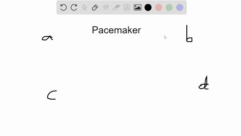 a-pacemaker-is-used-to-correct-a-coronary-artery-disease-b-cardiac-arrhythmias-c-heart-murmurs-d-hyp