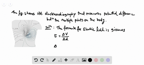standard-electrocardiography-measures-time-dependent-potential-differences-between-multiple-points-7