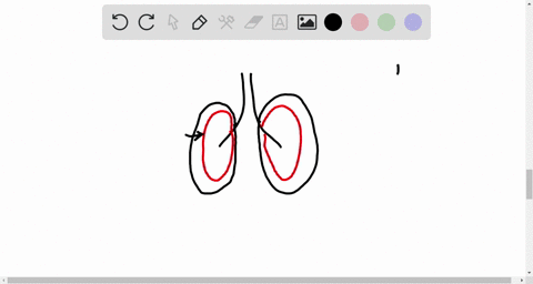 a-broken-rib-can-sometimes-puncture-a-lung-causing-it-to-collapse-a-collapsed-lung-leaks-air-into-th