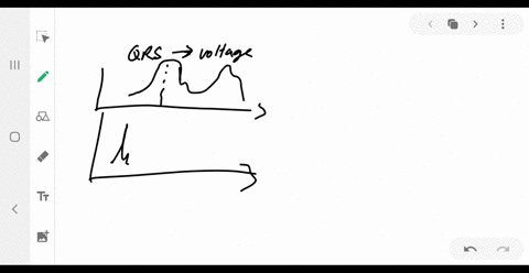 a-referring-to-figure-2034-find-the-time-systolic-pressure-lags-behind-the-middle-of-the-qrs-complex