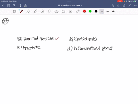 which-one-of-the-following-is-not-a-male-sex-accessory-gland-a-seminal-vesicle-b-epididymis-c-prosta