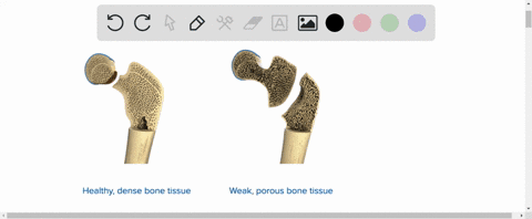 ⏩SOLVED:Why do you think wheelchair-bound people with paralyzed… | Numerade