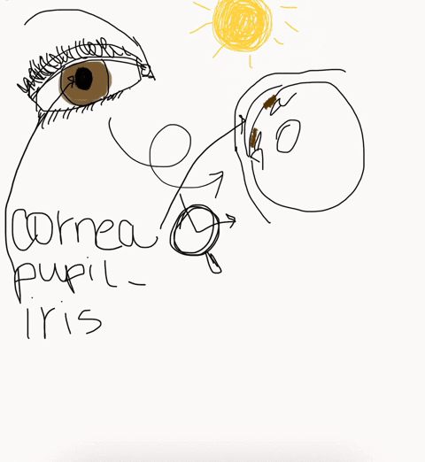 refer-to-this-drawing-of-the-eye-identify-the-structure-that-changes-to-allow-different-amounts-of-l