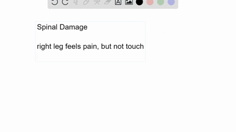 following-a-motorcycle-accident-the-victim-loses-the-ability-to-move-the-right-leg-but-has-normal-co