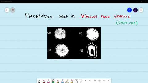 which-of-the-following-figures-represent-a-typical-placentation-as-seen-in-hibiscus-rosa-sinensis-ch