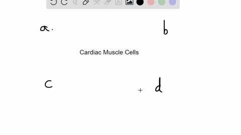 which-of-the-following-is-unique-to-cardiac-muscle-cells-a-only-cardiac-muscle-contains-a-sarcoplasm