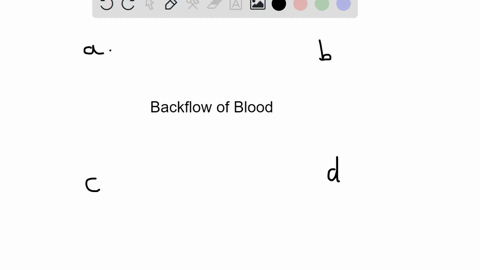 which-of-the-following-is-not-important-in-preventing-backflow-of-blood-a-chordae-tendineae-b-papill