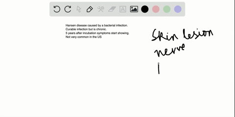 which-of-these-statements-concerning-hansens-disease-is-false-a-it-is-not-common-in-the-united-state