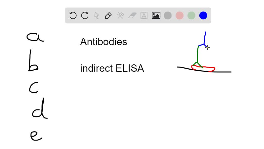 SOLVEDTiter refers to A. the most concentrated antigenantibody