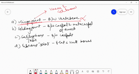 which-of-the-following-pairs-is-correctly-matched-a-hinge-joint-between-vertebrae-b-gliding-joint-be
