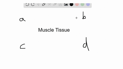 this-type-of-muscle-lacks-striations-a-smooth-muscle-b-skeletal-muscle-c-cardiac-muscle-d-all-of-the