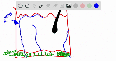 identify-the-structure-labeled-b-on-this-diagram-a-epidermis-b-hypodermis-c-dermis-d-adipose-tissue