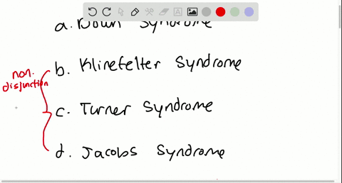trisomy-of-chromosome-21-is-called-a-down-syndrome-b-klinefelter-syndrome-c-turner-syndrome-d-jacobs