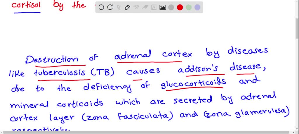 SOLVED:Assertion: A tumor of adrenal cortex may cause addison's disease ...