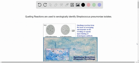 the-_______-is-used-to-serologically-identify-streptococcus-pneumoniae-isolates
