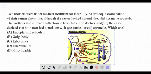 two-brothers-were-under-medical-treatment-for-infertility-microscopic-examination-of-their-semen-sho