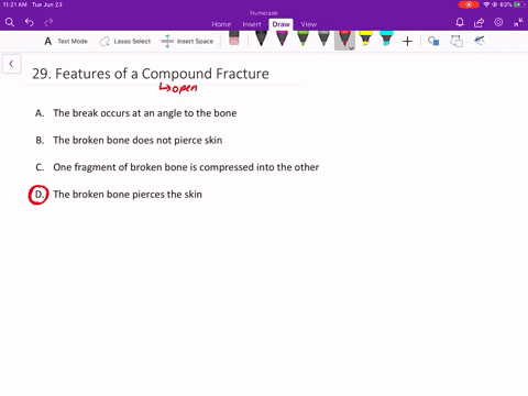 in-a-compound-fracture_______-a-the-break-occurs-at-an-angle-to-the-bone-b-the-broken-bone-does-not-