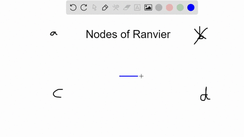 nodes-of-ranvier-are-found-a-at-the-tips-of-dendrites-b-on-the-surface-of-neuroglial-cells-c-along-t