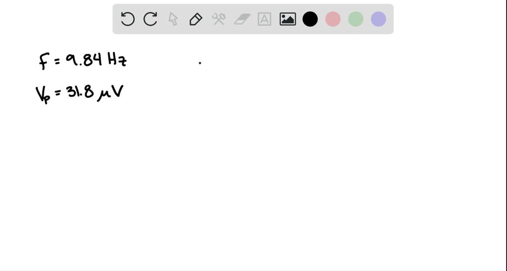 SOLVEDElectroencephalography (EEG) elucidates brain function by ana