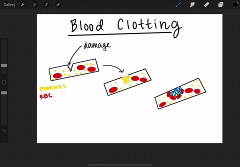 blood-clotting-a-is-impaired-in-patients-with-hemophilia-because-they-do-not-produce-platelets-b-is-