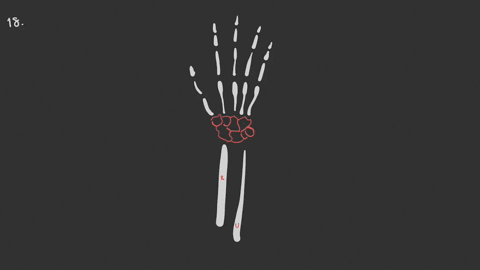 which-is-the-lateral-most-carpal-bone-of-the-proximal-row-a-trapezium-b-hamate-c-pisiform-d-scaphoid