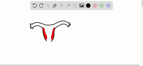 the-usual-site-of-embryo-implantation-is-a-the-uterine-tube-b-the-peritoneal-cavity-c-the-vagina-d-t