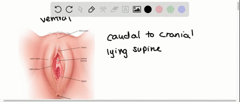 which-of-the-following-is-correct-relative-to-female-anatomy-a-the-vaginal-orifice-is-the-most-dorsa
